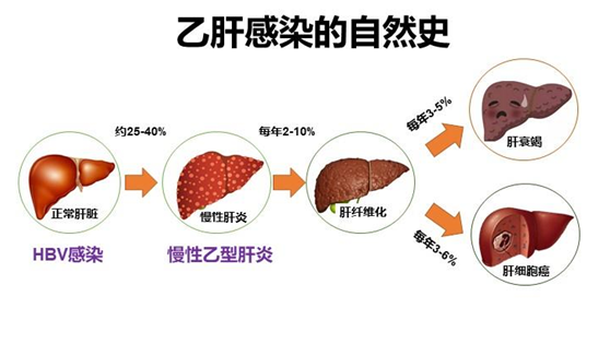 迪庆州人民医院肝病门诊——致力于乙肝临床治愈，守护您的“小心肝”